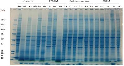 Proteomic Study of Fetal Membrane: Inflammation-Triggered Proteolysis of Extracellular Matrix May Present a Pathogenic Pathway for Spontaneous Preterm Birth